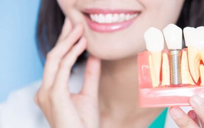 All about Dental Implants