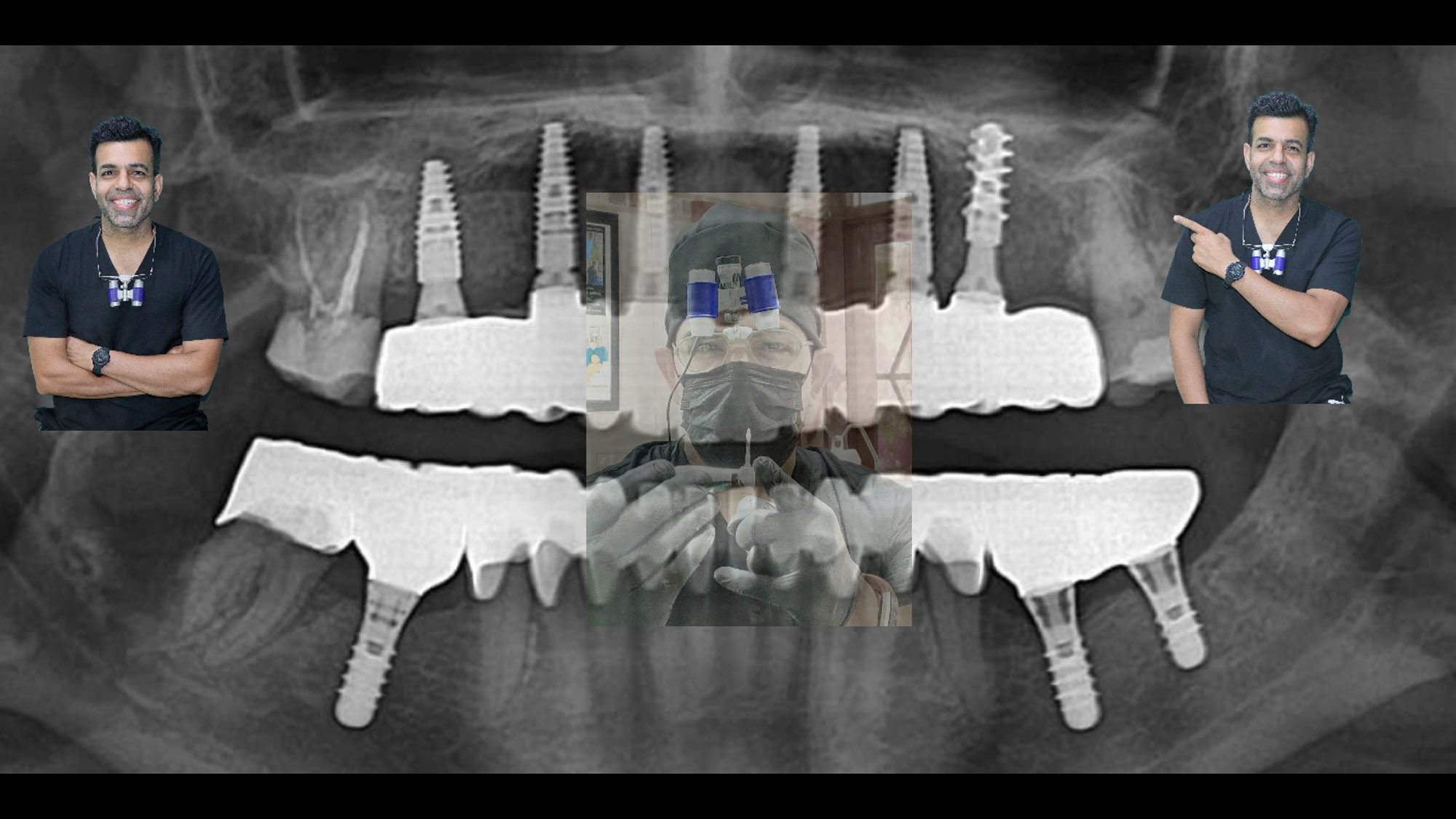 dental implants courses india