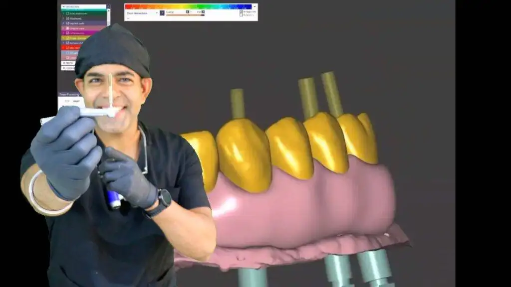 digital implants training