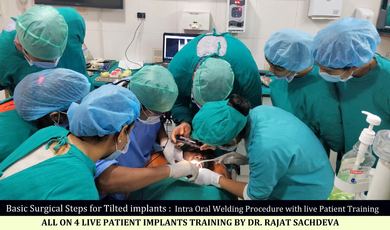 2 days all on 4 implants course-delhi