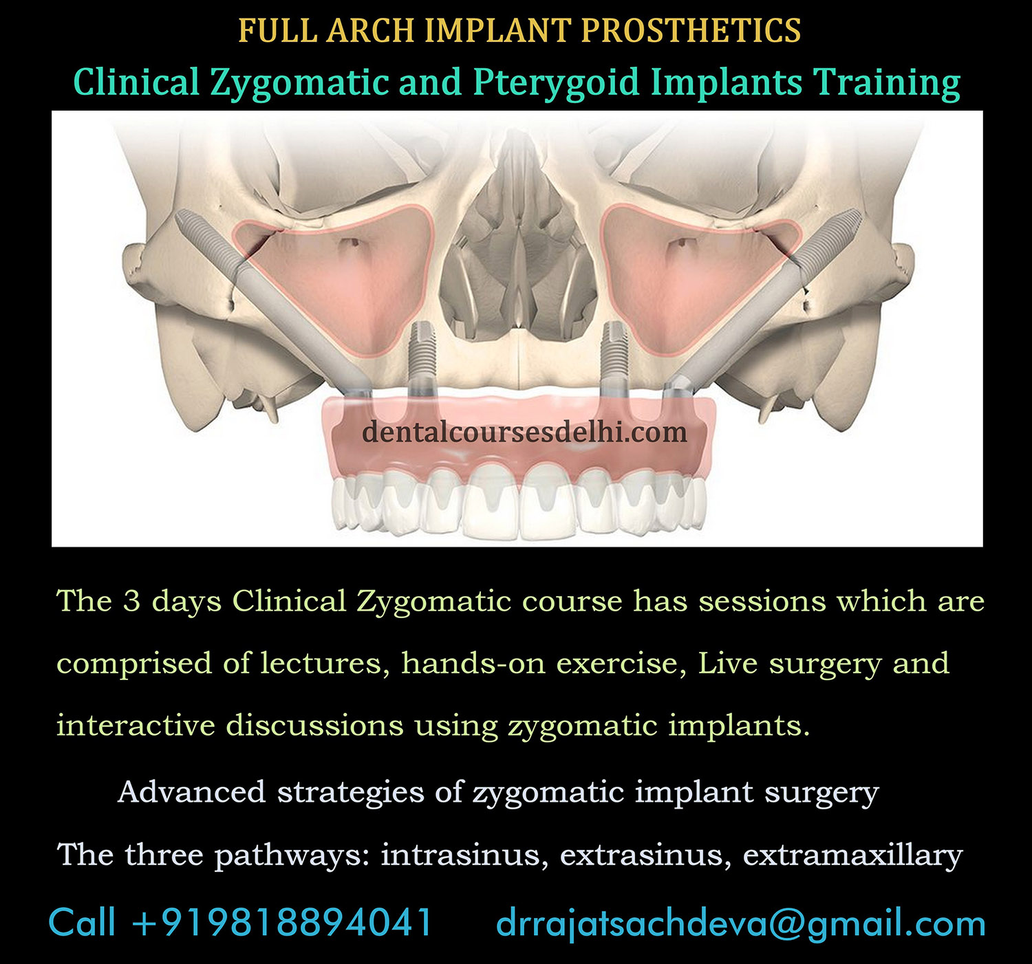 zygomatic course overview