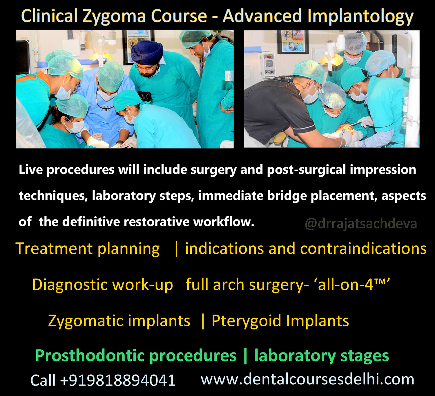 top zygomatic course