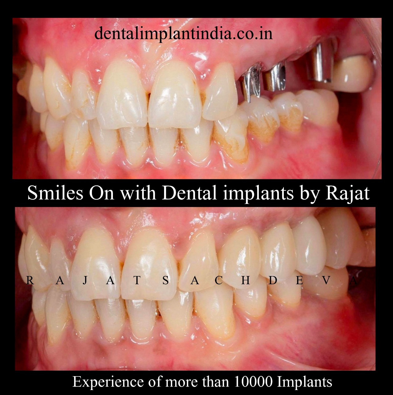 dental implants course objective
