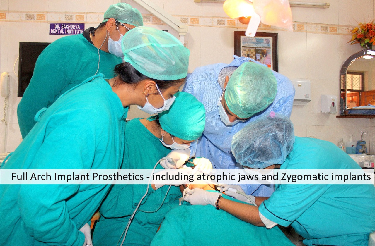 Clinical Zygomatic & Pterygoid Implant Course in India