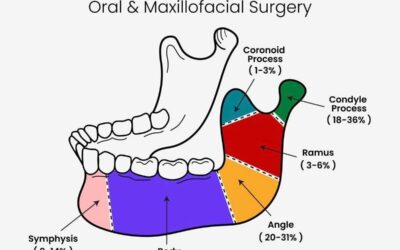 Understanding Mandibular Fracture Sites