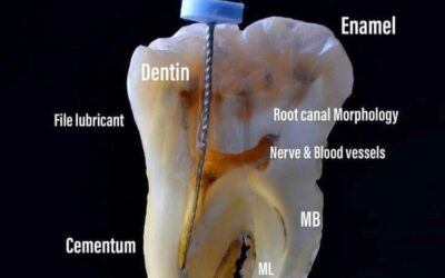 Unlocking the Mystery Inside a Tooth