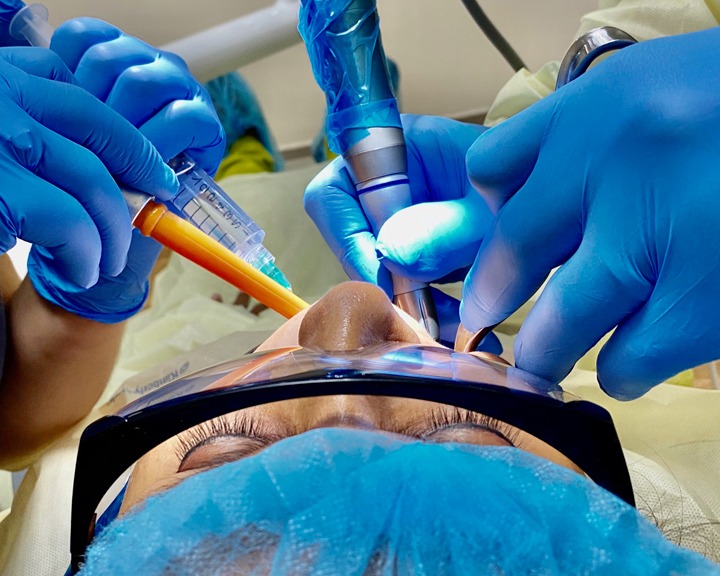 wisdom tooth extraction training