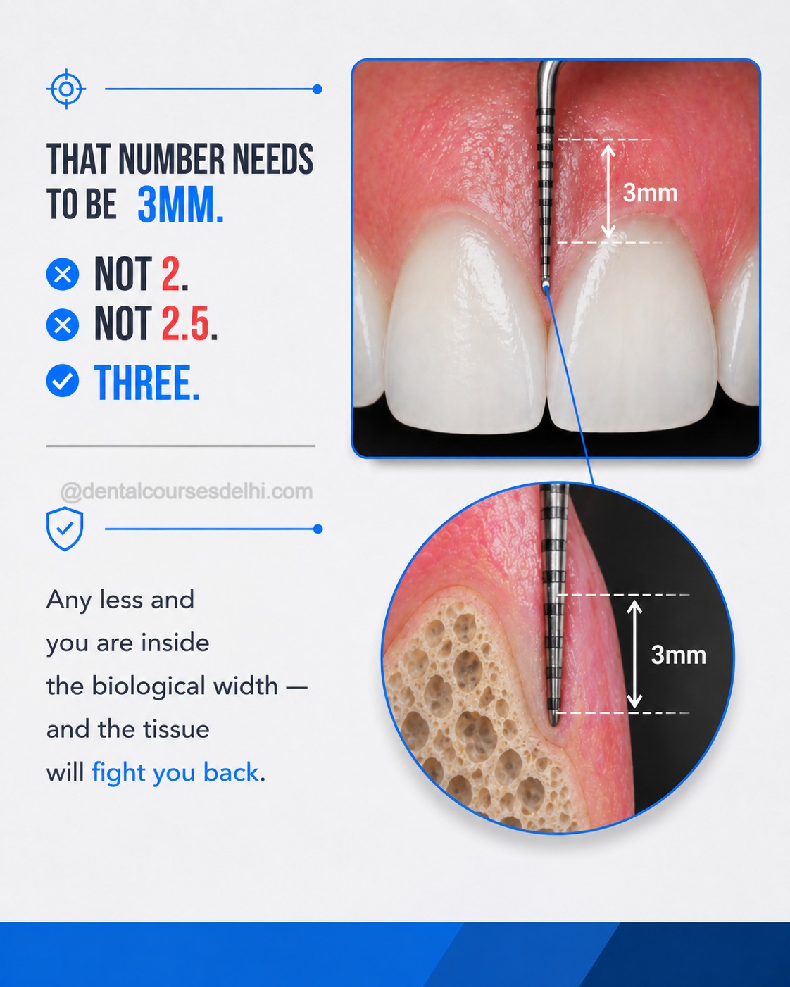 Why Some Gum Surgeries Relapse (And Others Last for Years) (3)