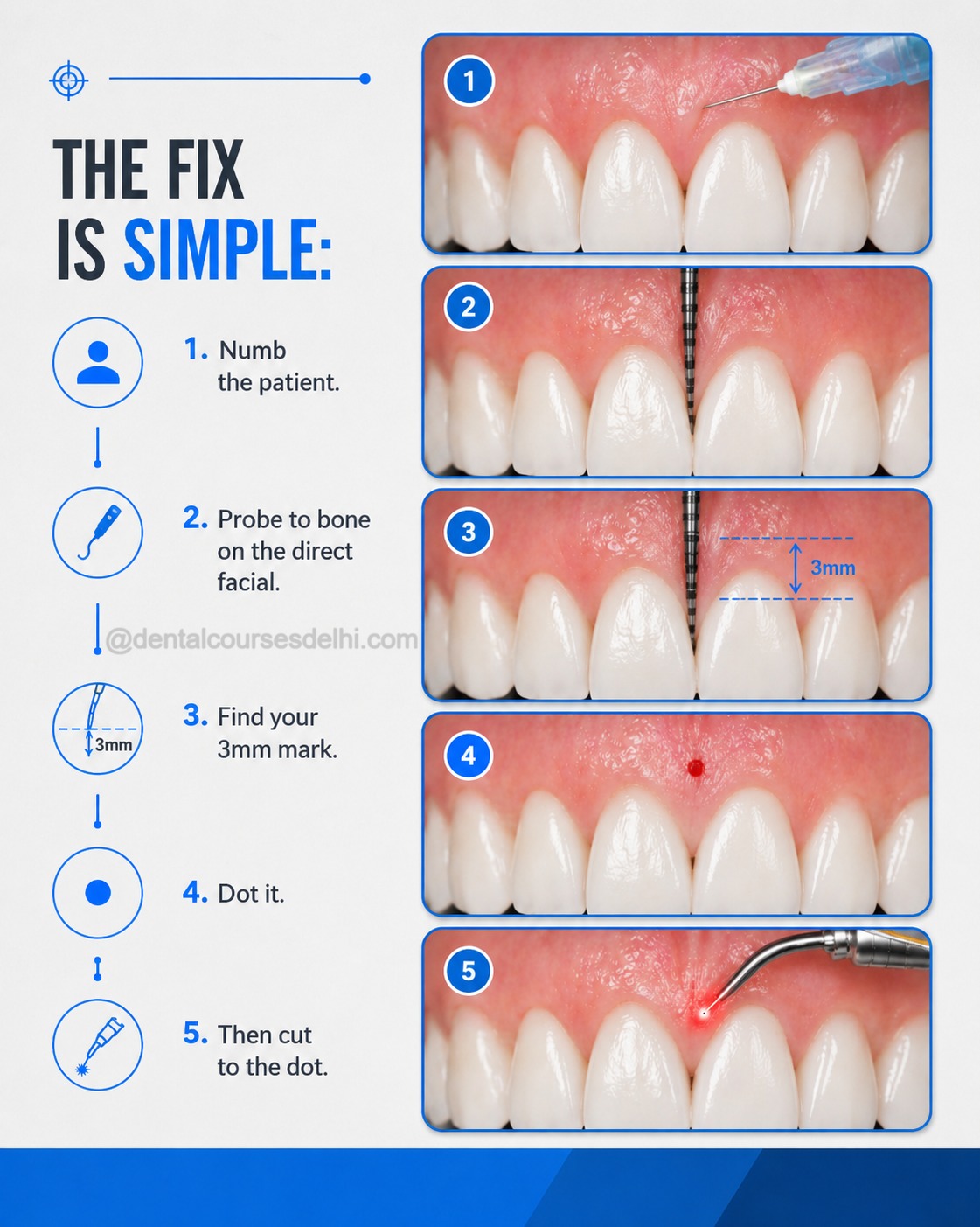Why Some Gum Surgeries Relapse (And Others Last for Years) (4)