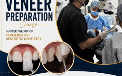 veneer course veneer course